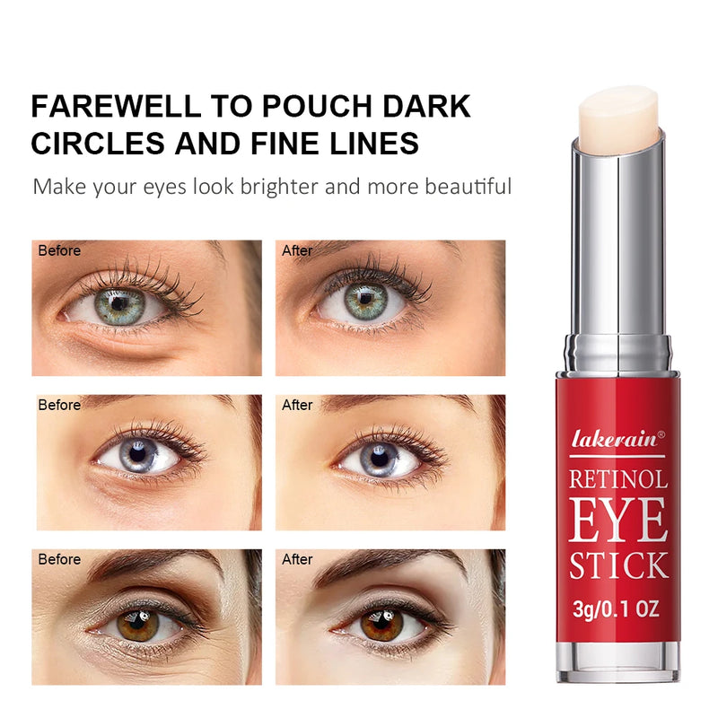 Anti-Wrinkle Eye Cream Retinol Remove Eye Bags Dark Circles Anti Aging
