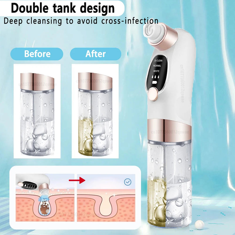 Blackhead Remover Pore Vacuum Face Cleaner Electric Pimple Acne Black