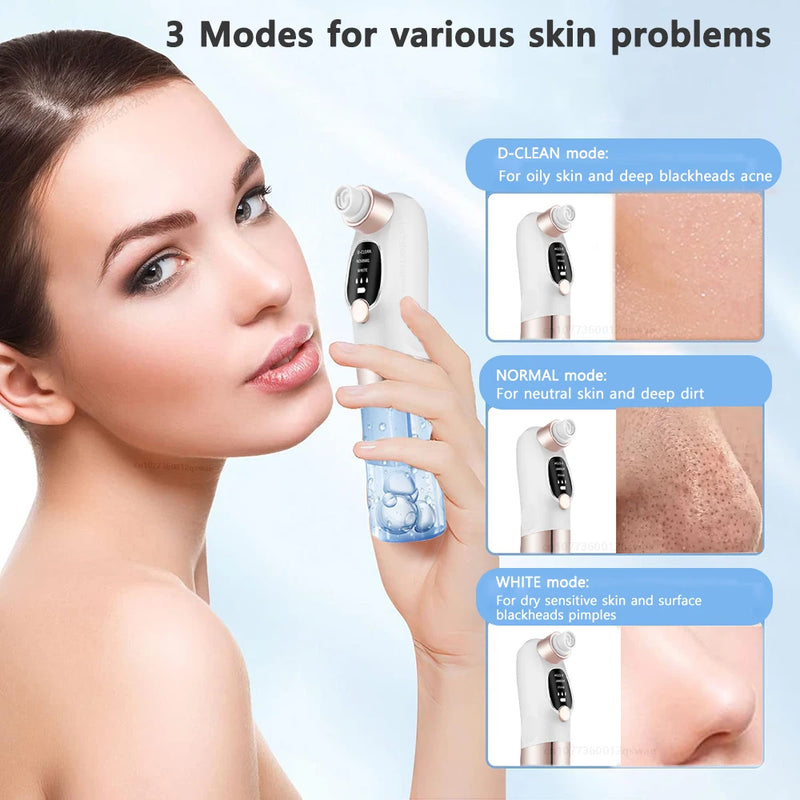 Blackhead Remover Pore Vacuum Face Cleaner Electric Pimple Acne Black
