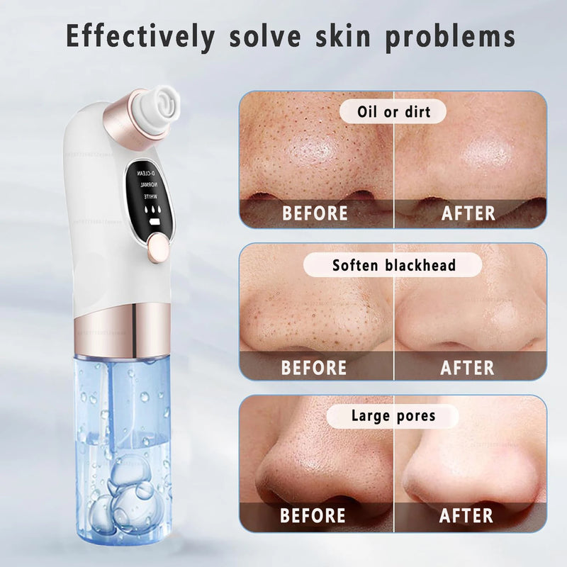 Blackhead Remover Pore Vacuum Face Cleaner Electric Pimple Acne Black