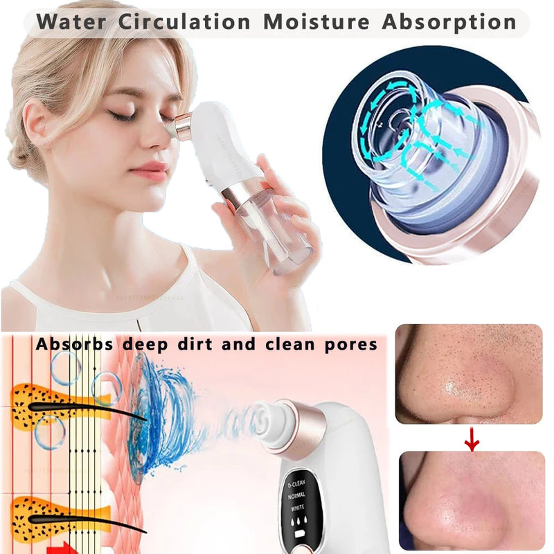 Blackhead Remover Pore Vacuum Face Cleaner Electric Pimple Acne Black